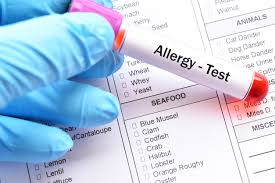Allergen 4